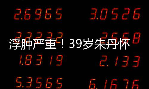 严重月 坚持朱丹直播带货7个怀孕9岁深夜浮肿